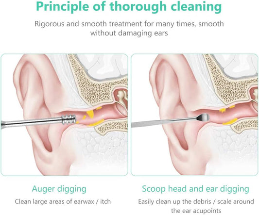 👂 Stainless Steel Dual-Head Ear Cleaning Tool – Hygienic &amp; Safe Wax Removal ✨